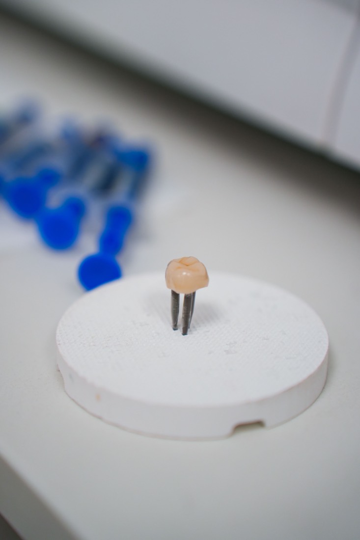 Implant restoration component on the milling spindle